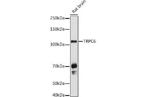 Western blot analysis of extracts of Rat brain, using TRPC6 antibody (ABIN6133946, ABIN6149580, ABIN6149581 and ABIN6224178) at 1:1000 dilution. (TRPC6 antibody  (AA 500-600))
