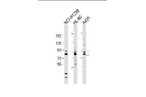 All lanes : Anti-P9 Antibody  at 1:2000 dilution Lane 1: NCI- whole cell lysate Lane 2: HL-60 whole cell lysate Lane 3: A431 whole cell lysate Lysates/proteins at 20 μg per lane. (MMP 9 antibody  (C-Term))
