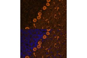Immunofluorescence analysis of rat brain cells using PKC gamma antibody (ABIN6133857, ABIN6146206, ABIN6146207 and ABIN6223918) at dilution of 1:100. (PKC gamma antibody)