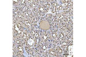 IHC analysis of SAP130 using anti-SAP130 antibody (ABIN7601247). (SAP130 antibody  (AA 309-913))