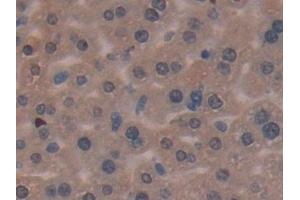 Detection of MMP7 in Mouse Liver Tissue using Polyclonal Antibody to Matrix Metalloproteinase 7 (MMP7)