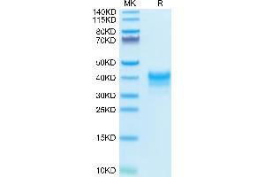 Cynomolgus/Rhesus macaque FOLR1 on Tris-Bis PAGE under reduced condition. (FOLR1 Protein (AA 25-233) (His tag))