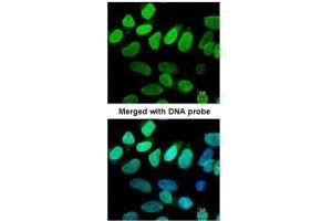 ICC/IF Image Immunofluorescence analysis of paraformaldehyde-fixed HeLa, using VCP(p97), antibody at 1:200 dilution. (VCP antibody  (N-Term))