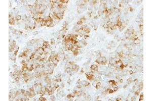 IHC-P Image Immunohistochemical analysis of paraffin-embedded MCF7 xenograft, using KYNU, antibody at 1:500 dilution. (KYNU antibody)