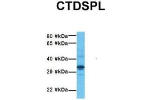 Host:  Rabbit  Target Name:  CTDSPL  Sample Tissue:  Human Fetal Liver  Antibody Dilution:  1. (CTDSPL antibody  (N-Term))