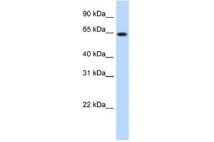WB Suggested Anti-RNF6 Antibody Titration:  1. (RNF6 antibody  (N-Term))