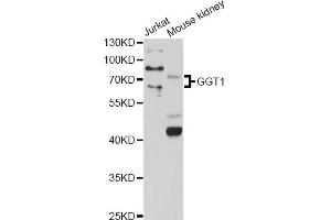 Western blot analysis of extracts of various cell lines, using GGT1 antibody (ABIN1872809) at 1:1000 dilution. (GGT1 antibody)