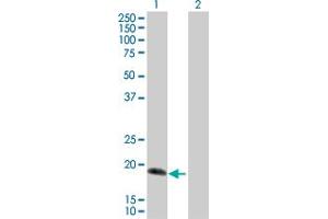 Western Blot analysis of IL17C expression in transfected 293T cell line by IL17C MaxPab polyclonal antibody. (IL17C antibody  (AA 1-197))