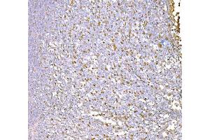 IHC analysis of SND1 using anti-SND1 antibody (ABIN7600525).