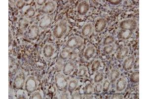 Image no. 1 for anti-SUMO1/sentrin Specific Protease 6 (SENP6) (AA 1-111) antibody (ABIN599203) (SENP6 antibody  (AA 1-111))