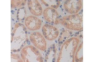 Used in DAB staining on fromalin fixed paraffin- embedded kidney tissue (PLCD4 antibody  (AA 1-250))