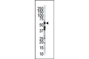 The anti-ZSTE24 Pab (ABIN389049 and ABIN2839258) is used in Western blot to detect ZSTE24 in T-47D cell lysate. (ZMPSTE24 antibody  (C-Term))