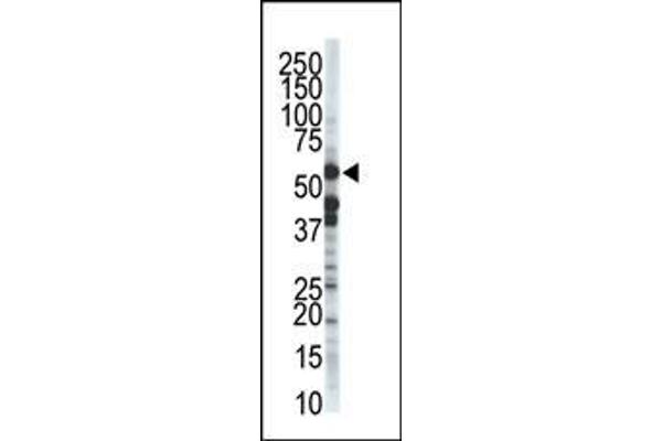 ZMPSTE24 antibody  (C-Term)