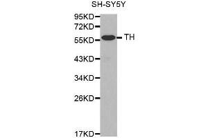 Western Blotting (WB) image for anti-Tyrosine Hydroxylase (TH) antibody (ABIN6213590) (Tyrosine Hydroxylase antibody)
