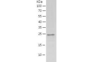 Western Blotting (WB) image for Mediator Complex Subunit 19 (MED19) (AA 1-194) protein (His tag) (ABIN7123870) (MED19 Protein (AA 1-194) (His tag))