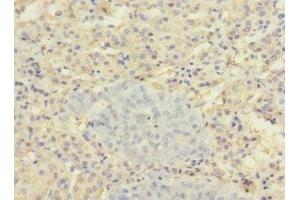 Immunohistochemistry of paraffin-embedded human adrenal gland tissue using ABIN7170165 at dilution of 1:100 (SLC22A8 antibody  (AA 473-542))