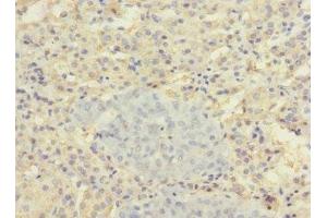Immunohistochemistry of paraffin-embedded human adrenal gland tissue using ABIN7170165 at dilution of 1:100