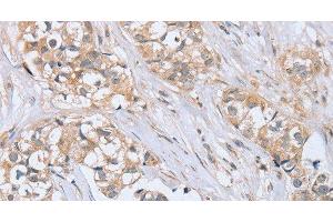 PTPN4 antibody