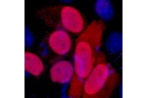 Immunofluorescent analysis of FLAG-tag staining in 293T cells transfected with a Flag-tag protein. (DYKDDDDK Tag antibody)