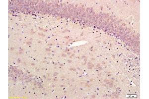 Formalin-fixed and paraffin embedded rat hippocampus labeled with Rabbit Anti-alpha-Synuclein (NT) Polyclonal Antibody, Unconjugated  1:300 followed by conjugation to the secondary antibody and DAB staining (SNCA antibody  (AA 51-90))
