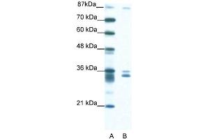 WB Suggested Anti-PKNOX2 Antibody Titration: 1. (PKNOX2 antibody  (N-Term))