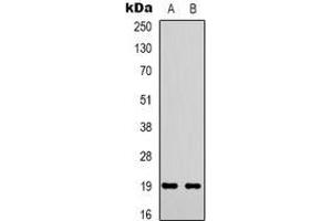 Western blot analysis of STMN1 (pS38) expression in Hela (A), Jurkat (B) whole cell lysates. (Stathmin 1 antibody  (N-Term, pSer38))