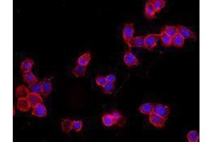 Immunofluorescence (IF) image for anti-Epithelial Cell Adhesion Molecule (EPCAM) antibody (Alexa Fluor 594) (ABIN2656830) (EpCAM antibody  (Alexa Fluor 594))