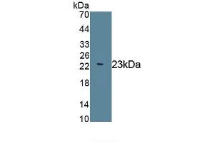 Detection of Recombinant MANF, Human using Monoclonal Antibody to Mesencephalic Astrocyte Derived Neurotrophic Factor (MANF) (MANF antibody  (AA 28-182))