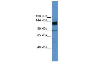 OGDHL antibody used at 0. (OGDHL antibody  (N-Term))