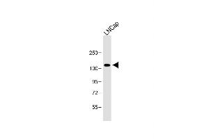 Anti-POTEE Antibody (Center) at 1:1000 dilution + LNCap whole cell lysate Lysates/proteins at 20 μg per lane. (POTEE antibody  (AA 380-409))
