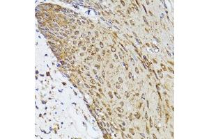 Immunohistochemistry of paraffin-embedded human esophagus using TOLLIP antibody. (TOLLIP antibody)