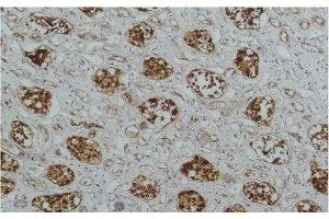 Immunohistochemistry of paraffin-embedded Human kidney tissue using NFKBIB Monoclonal Antibody at dilution of 1:200. (NFKBIB antibody)