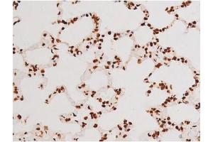 Immunohistochemistry (IHC) image for anti-REL proto-oncogene (c-Rel) (pSer503) antibody (ABIN6255382)