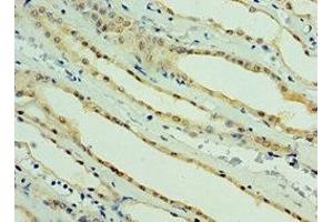 Immunohistochemistry of paraffin-embedded human kidney tissue using ABIN7164272 at dilution of 1:100 (PARL antibody  (AA 1-170))