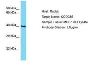 CCDC86 antibody  (AA 101-150)
