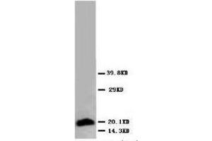 anti-Myosin, Slow Muscle antibody