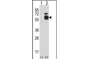 Western blot analysis of Acvr1 (arrow) using rabbit polyclonal Mouse Acvr1 Antibody (Center) (ABIN657718 and ABIN2846706). (ACVR1 antibody  (AA 137-166))