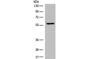 Western blot analysis of Jurkat cell lysate using M1AP Polyclonal Antibody at dilution of 1:600