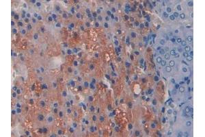 IHC-P analysis of Rat Adrenal gland Tissue, with DAB staining. (ADAMTS1 antibody  (AA 854-967))