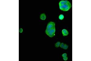 Immunofluorescence (IF) image for anti-GDP Dissociation Inhibitor 1 (GDI1) (AA 35-170) antibody (ABIN7166949)