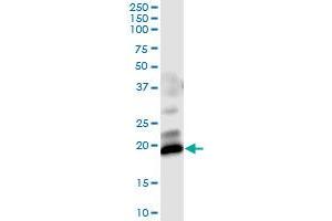 Immunoprecipitation of GUCA1C transfected lysate using anti-GUCA1C MaxPab rabbit polyclonal antibody and Protein A Magnetic Bead , and immunoblotted with GUCA1C purified MaxPab mouse polyclonal antibody (B01P) . (GUCA1C antibody  (AA 1-209))