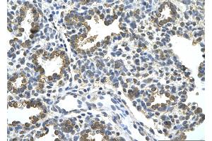 Rabbit Anti-HDAC9 Antibody       Paraffin Embedded Tissue:  Human alveolar cell   Cellular Data:  Epithelial cells of renal tubule  Antibody Concentration:   4. (HDAC9 antibody  (C-Term))