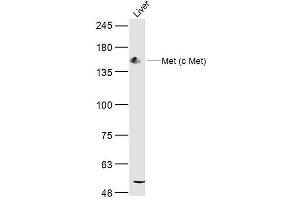 Mouse Liver lysates probed with Met (c Met) Polyclonal Antibody, Unconjugated  at 1:300 dilution and 4˚C overnight incubation. (c-MET antibody  (AA 801-900))