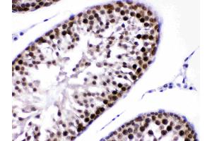Immunohistochemistry (IHC) image for anti-Exportin 1 (XPO1) (AA 966-1071) antibody (ABIN4886771)