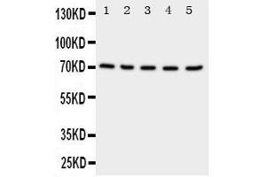 Anti-NRG1 antibody, Western blotting Lane 1: Rat Spleen Tissue Lysate Lane 2: Rat Kidney Tissue Lysate Lane 3: Rat Brain Tissue Lysate Lane 4: HELA Cell Lysate Lane 5: SMMC Cell Lysate