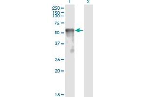 Western Blotting (WB) image for anti-Sestrin 2 (SESN2) (AA 1-481) antibody (ABIN466250) (Sestrin 2 antibody  (AA 1-481))