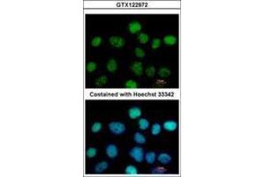 ZNF597 Antikörper  (AA 174-415)