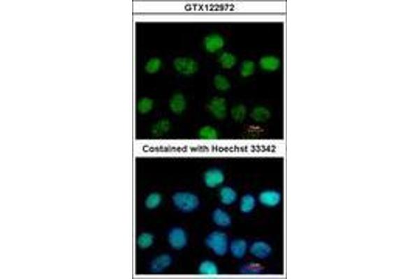ZNF597 Antikörper  (AA 174-415)