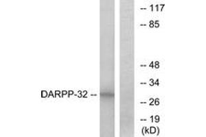 Western blot analysis of extracts from COS7 cells, treated with forskolin 40nM 30', using DARPP-32 (Ab-34) Antibody. (DARPP32 antibody  (AA 18-67))