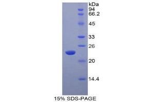 SDS-PAGE (SDS) image for Interferon, alpha 5 (IFNA5) (AA 24-189) protein (His tag) (ABIN1879014)